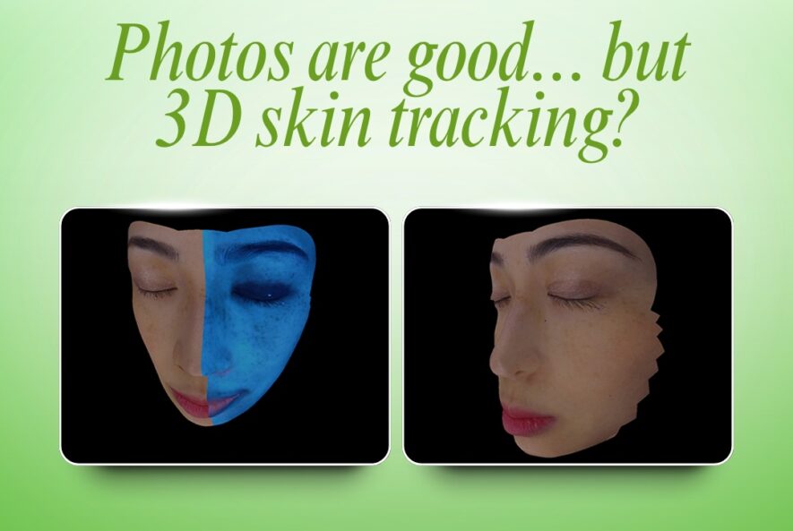 3D Skin Tracking